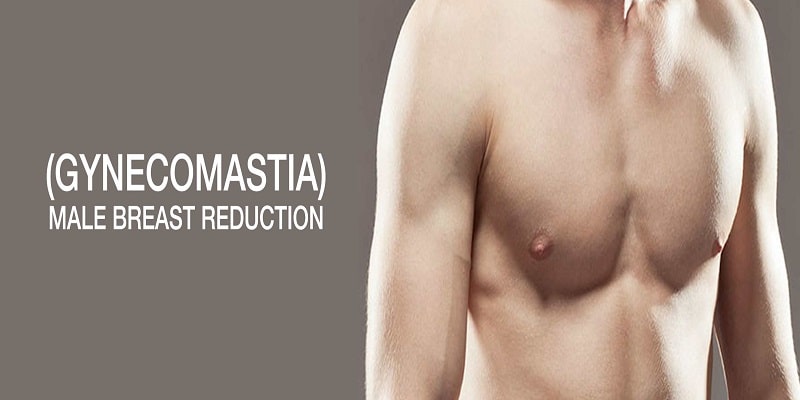 Gynecomastia Insights: Unveiling Surgical Options, Costs, and Alternatives in Lahore, Pakistan