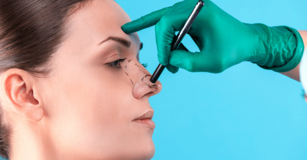 Crafting Your Ideal Profile - The Art of Rhinoplasty in Lahore